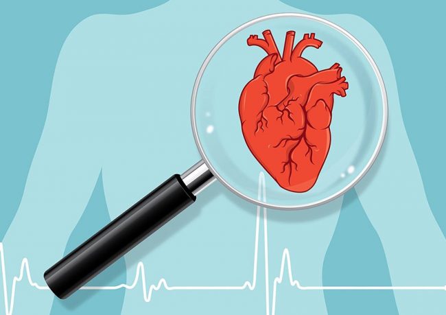 insuficienta-cardiaca-1