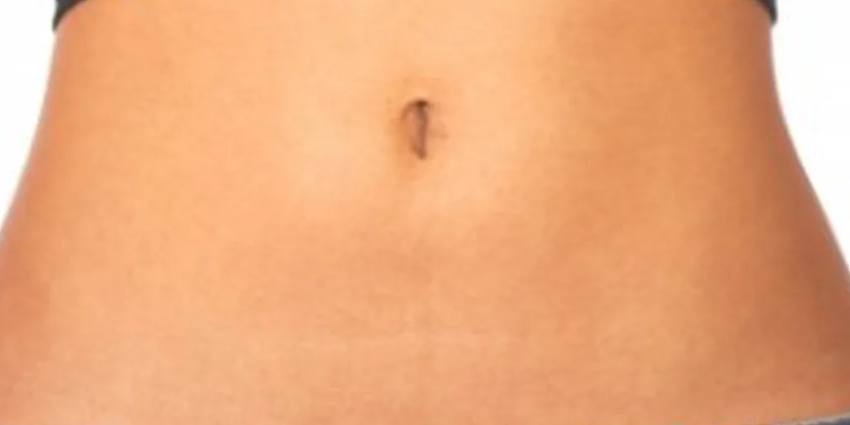 abdomen-plat