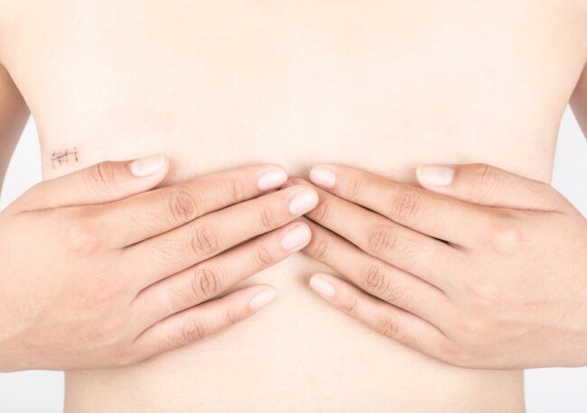 Scars,From,Surgery,Breast