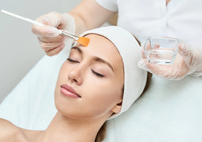peeling-chimic