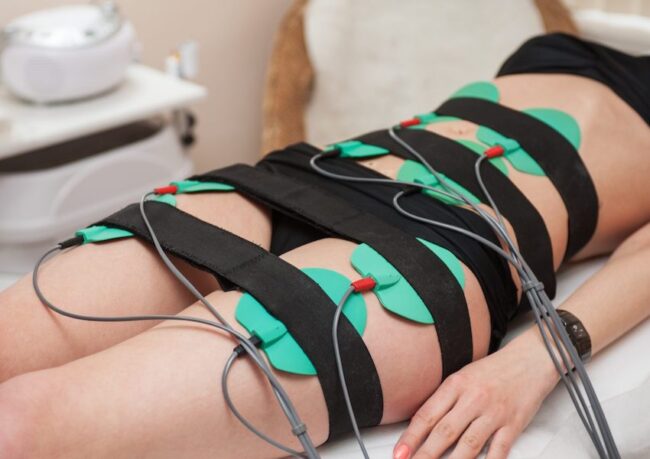 electrostimulare